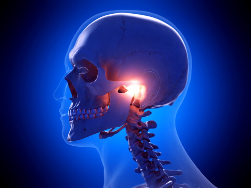 Neurological